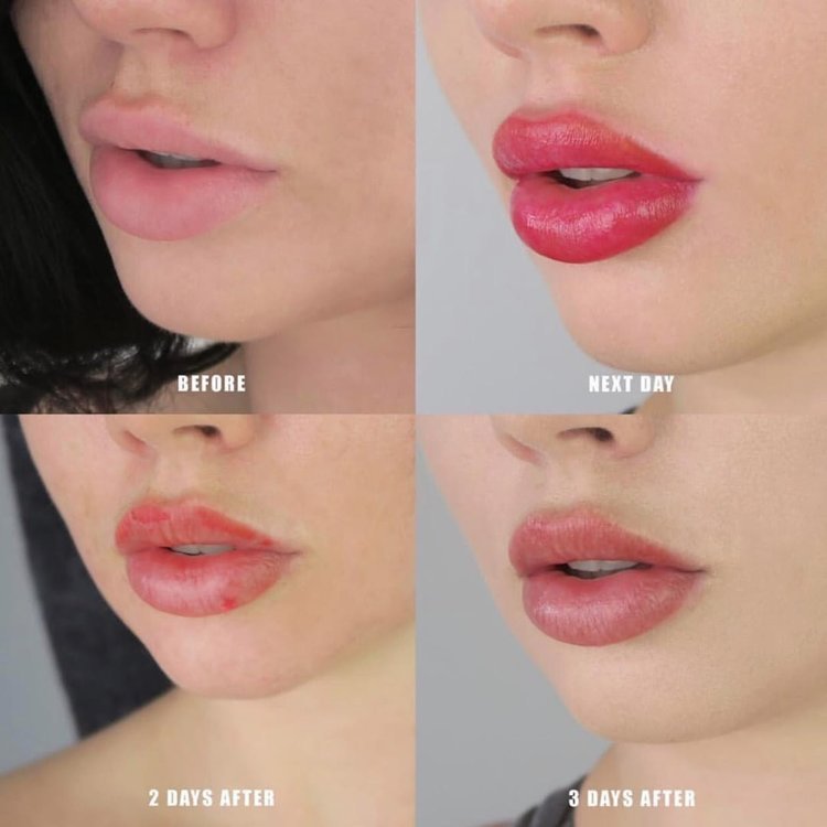 Permanent lip Makeup Tattoo Glendale
